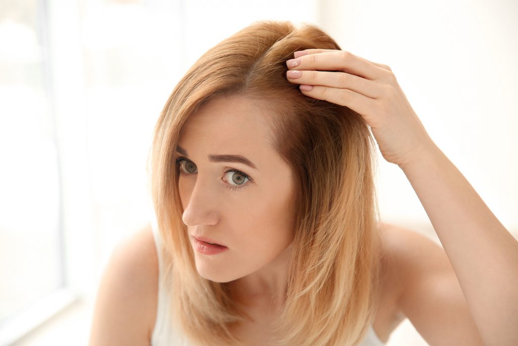 Women's Hair Loss Solutions