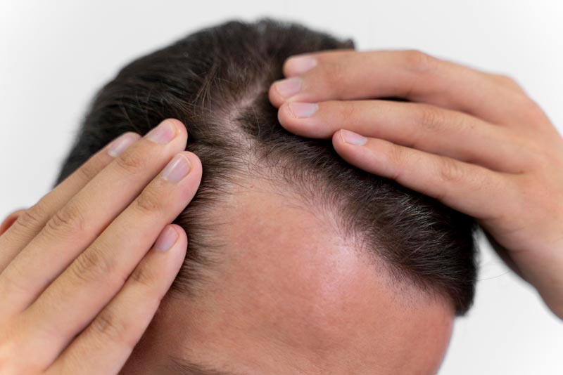 8 Common Hair Problems Hair Clinics Near Me Can Solve