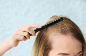 How to Maintain Hair Growth After Treatment at a Hair Loss Clinic