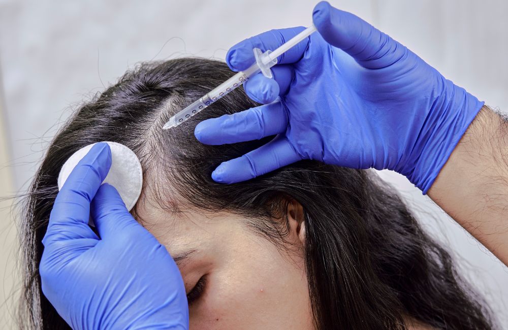 What Are the Different Types of Hair Loss Treatments?