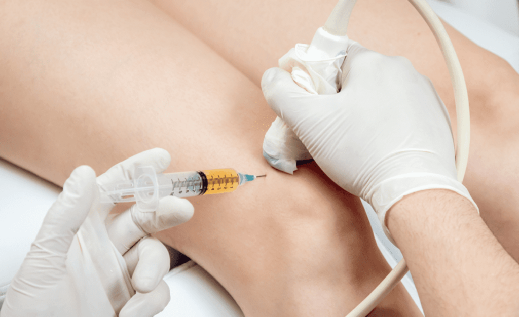 What Does a PRP Injection Procedure Look Like?