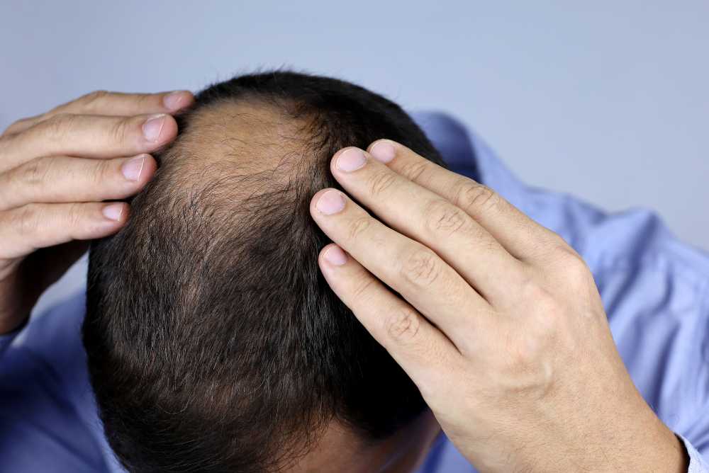 Manage Stress to Protect Hair Health