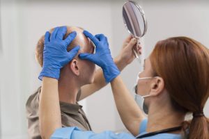 Hair Loss