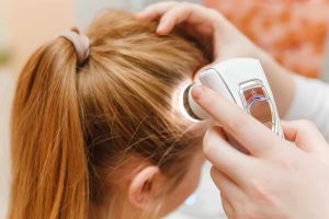 Hair Loss Clinics Diagnose