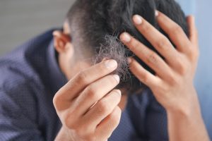 hairloss