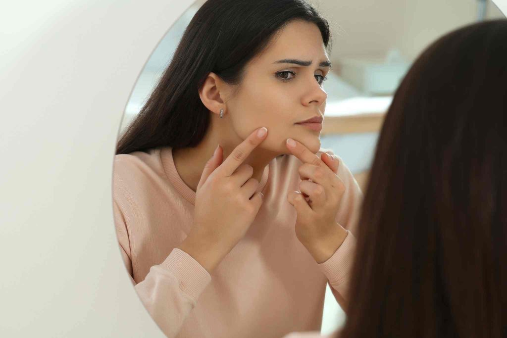 Persistent Acne or Skin Changes