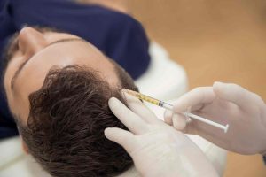 Stem Cell Therapy for Hair