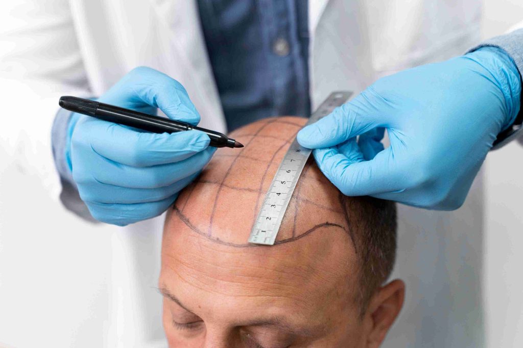 Healthcare Provider for Microneedling