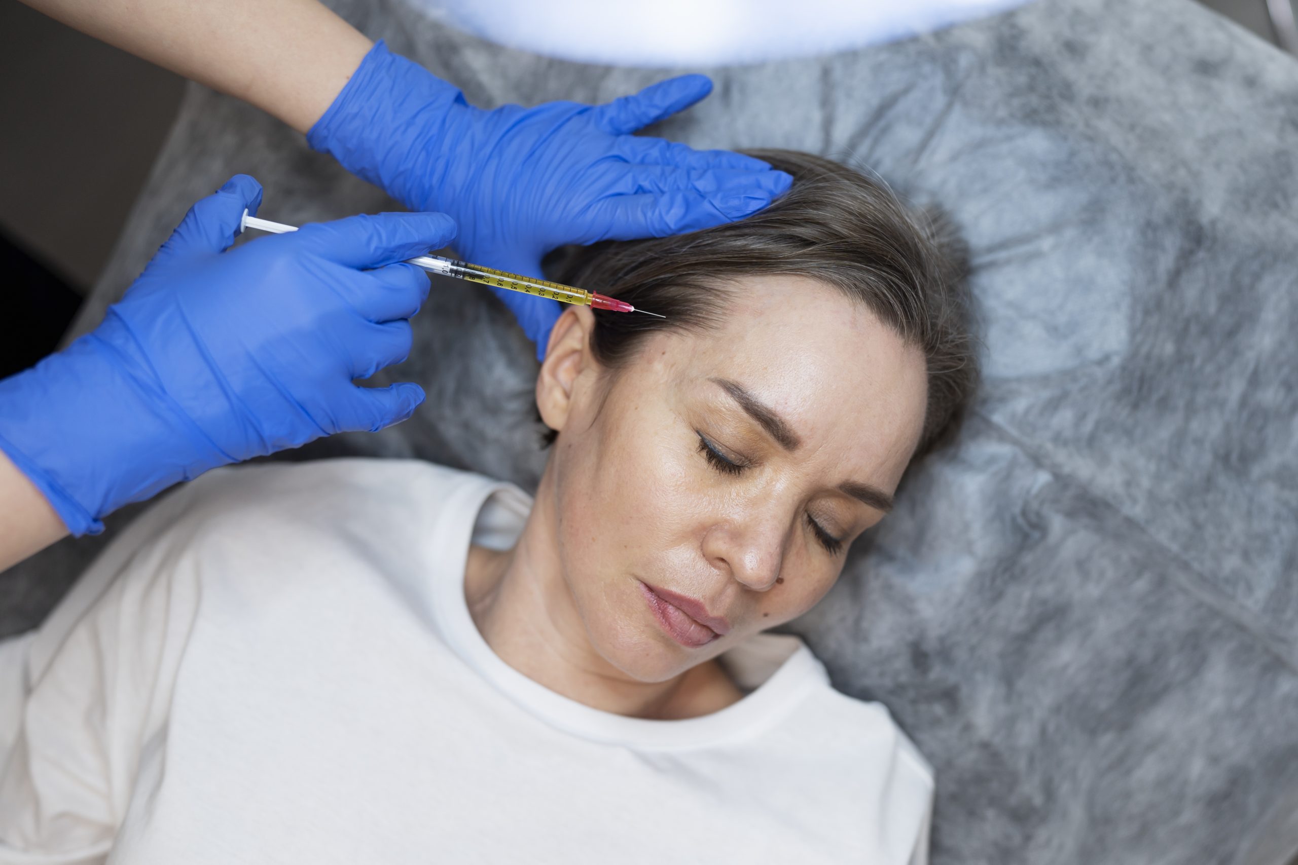 top-view-woman-getting-prp-treatment-scaled.jpg