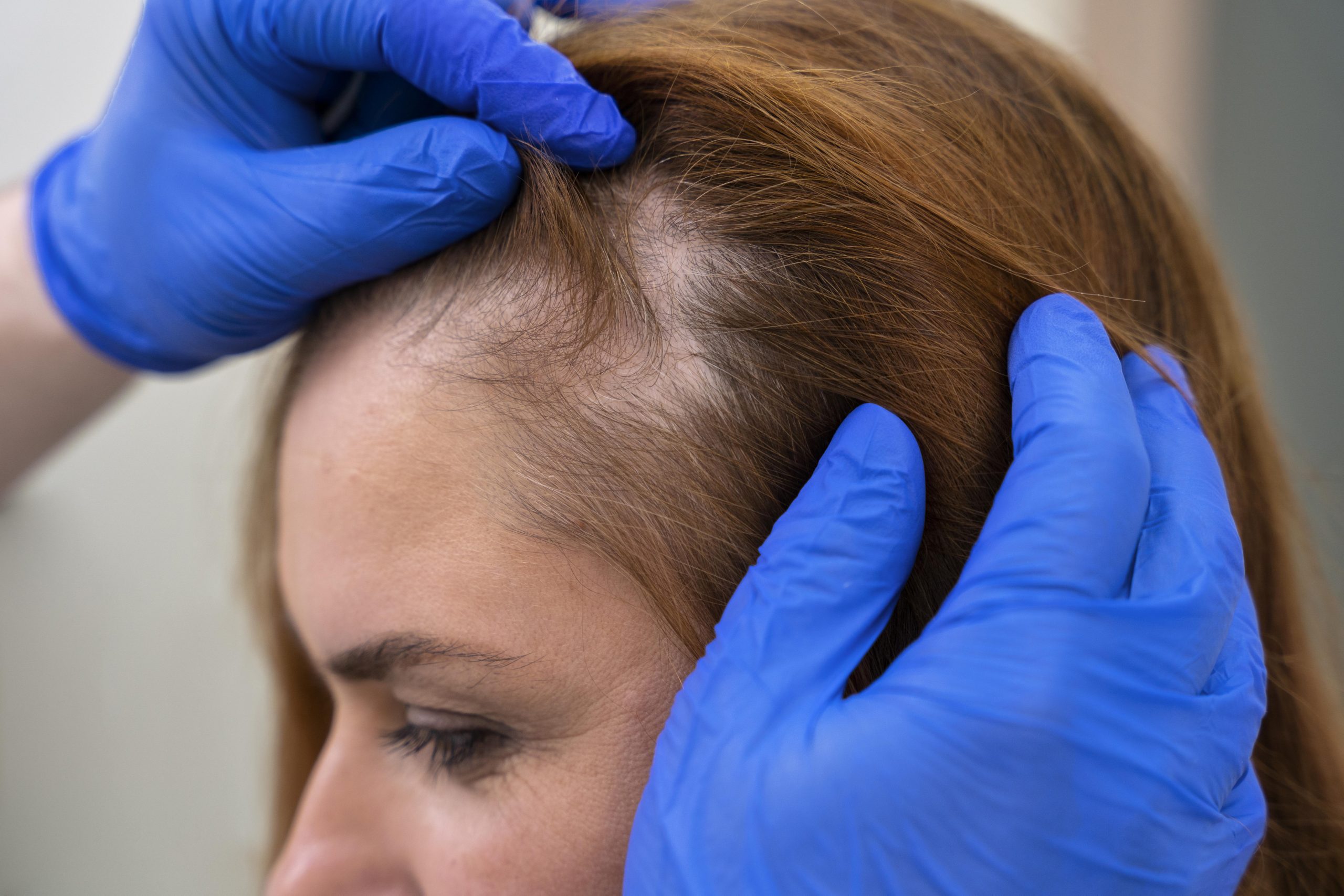 woman-getting-hair-loss-treatment-clinic-scaled.jpg
