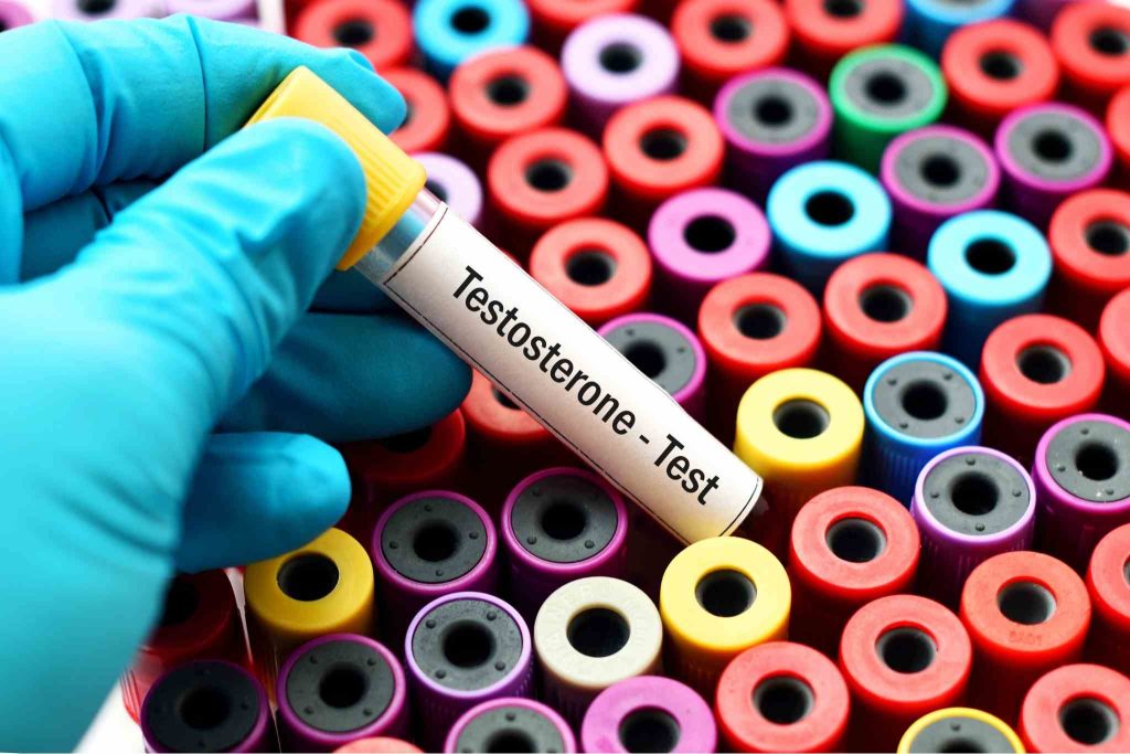 Test Testosterone Levels
