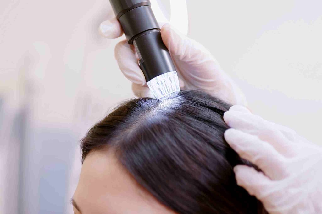 Right Professional for Microneedling