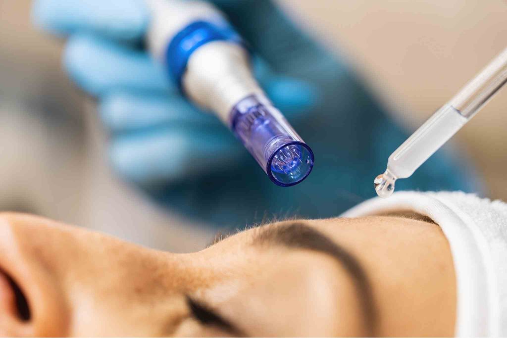 Face Microneedling