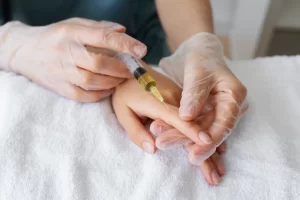 Medical professional wearing gloves administering injection into patient’s hand during treatment procedure
