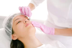 Prp treatment for face