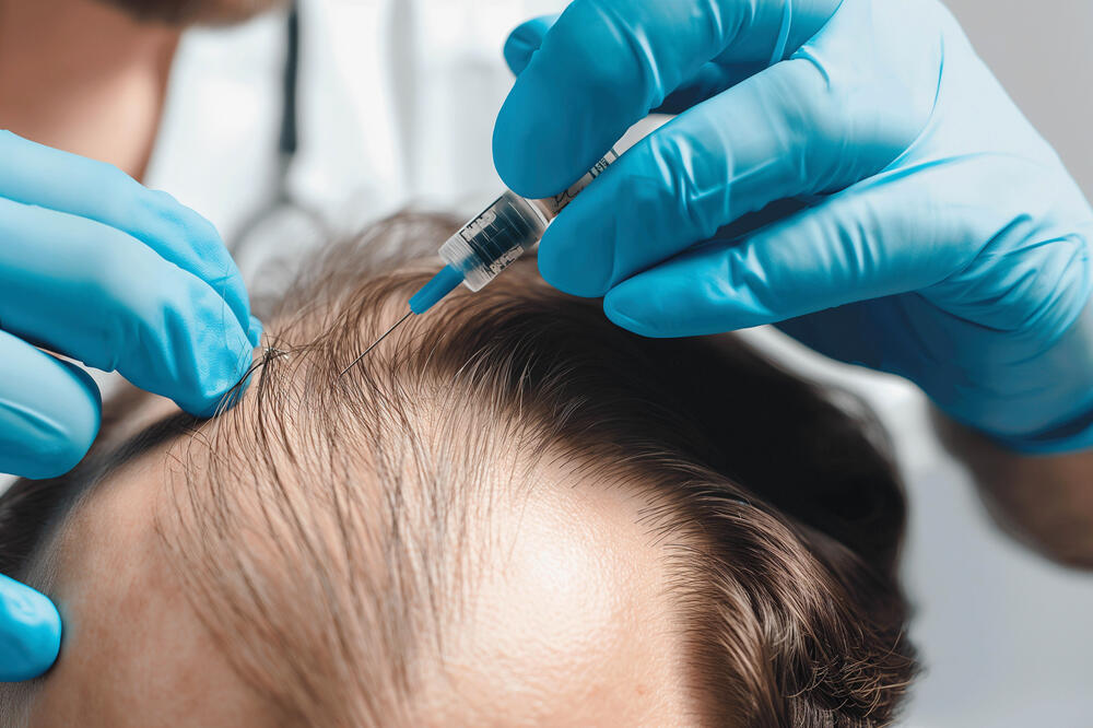 Treatment Options for Female Pattern Baldness