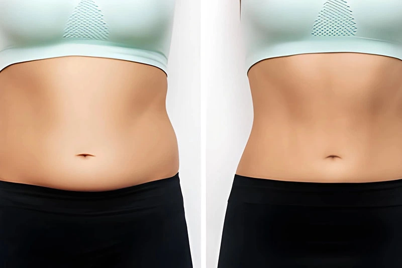 Accufit