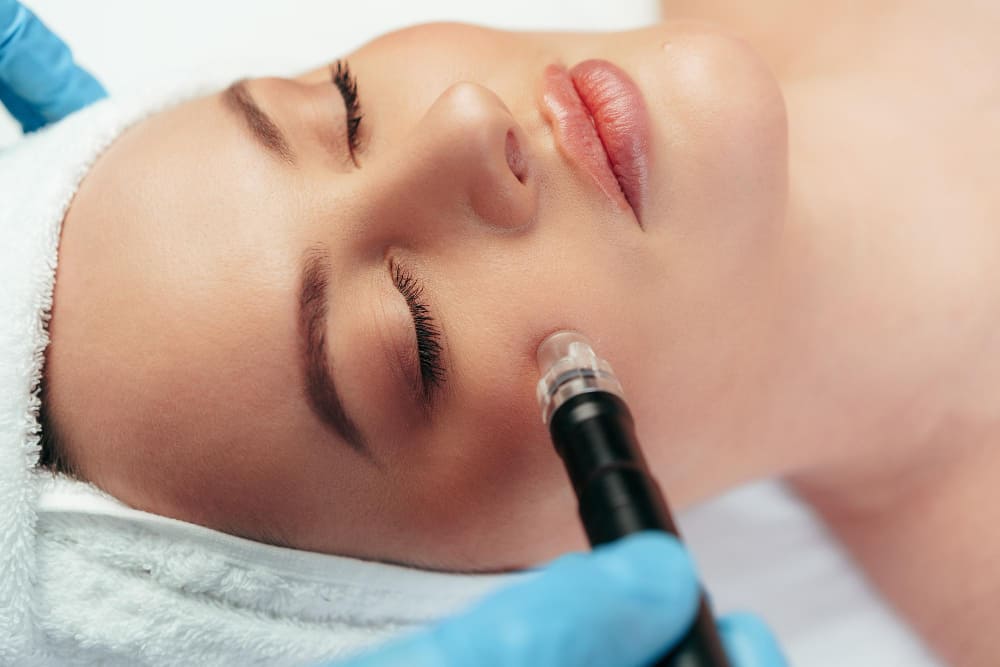 Facial Microneedling