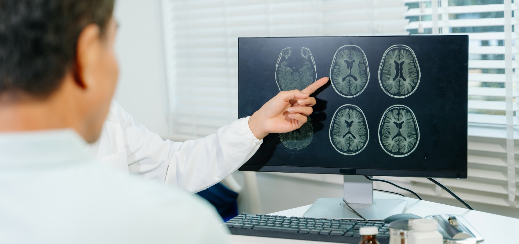 brain MRI scan on a computer screen