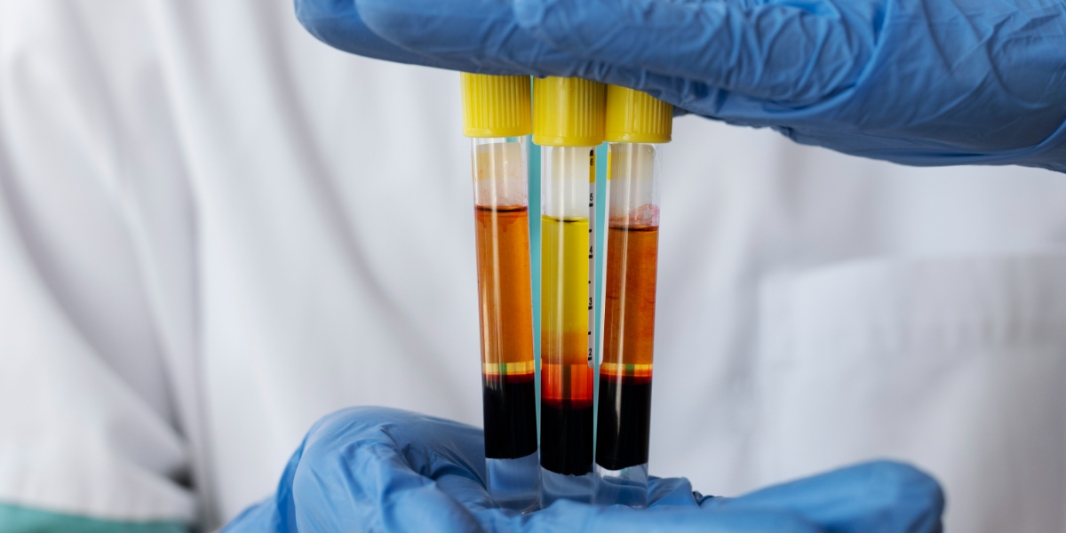 medical professional holding prp vials