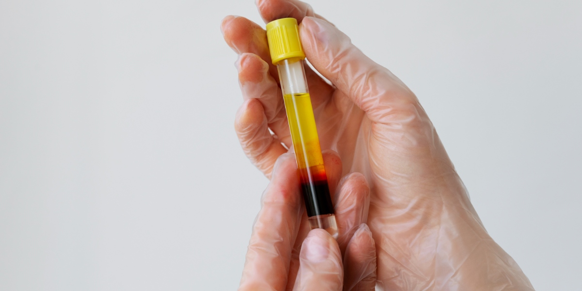 hands holding vial