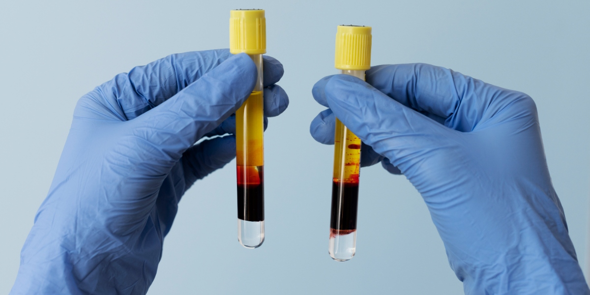 prp vials