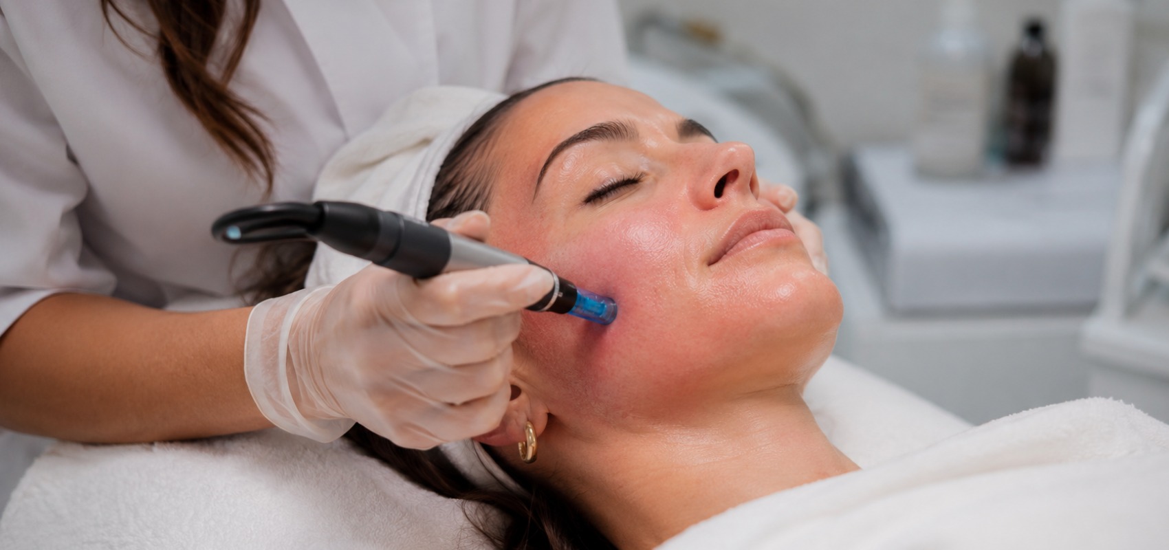 receiving a microneedling facial treatment